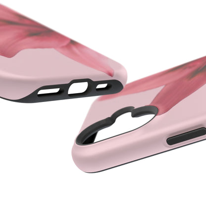 This is Gorgeous Case